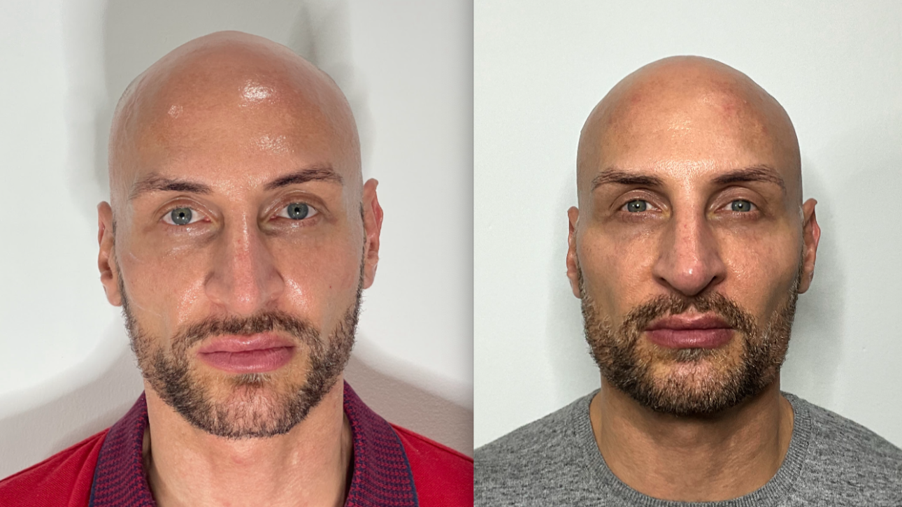 Screen Shot 2025-08-13 at 10.06.05