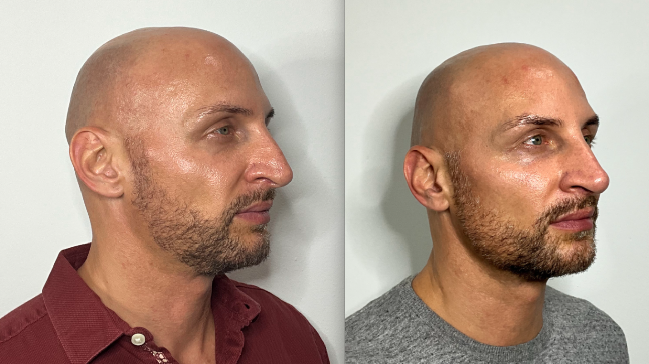 Screen Shot 2025-08-13 at 10.08.29