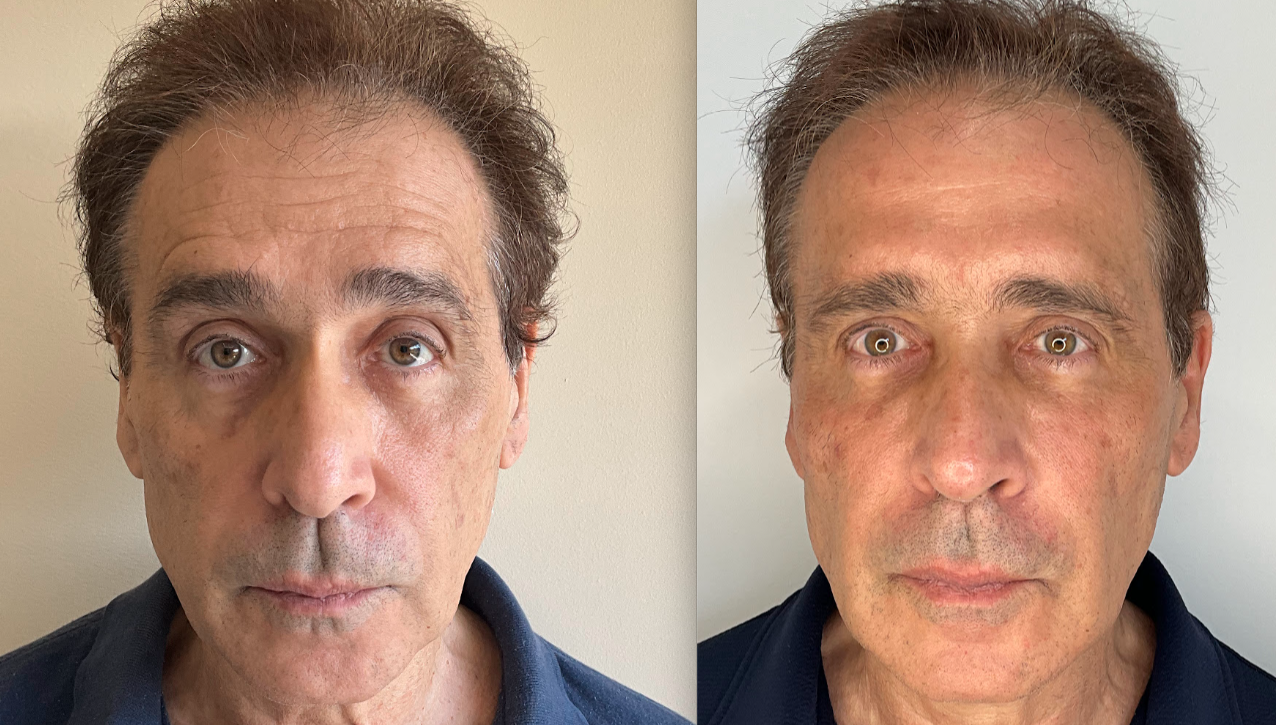 Screen Shot 2025-08-13 at 10.13.37